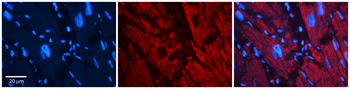 ZYX Rabbit Polyclonal Antibody