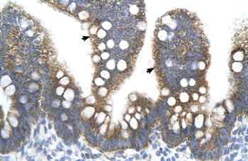 TFB2M Rabbit Polyclonal Antibody