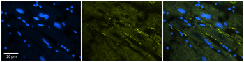 SCN5A Rabbit Polyclonal Antibody