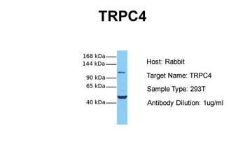 TRPC4 Rabbit Polyclonal Antibody