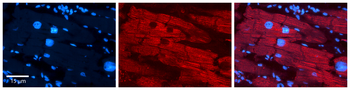 CITED2 Rabbit Polyclonal Antibody