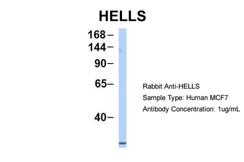 HELLS Rabbit Polyclonal Antibody