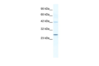 GJB4 Rabbit Polyclonal Antibody