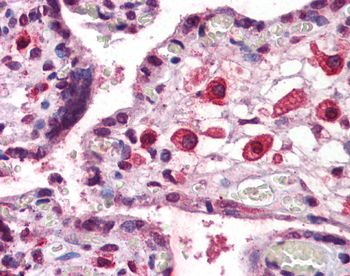Eomes Rabbit Polyclonal Antibody