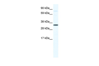 MSX1 Rabbit Polyclonal Antibody
