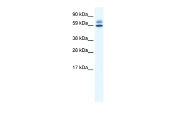 ZBTB38 Rabbit Polyclonal Antibody