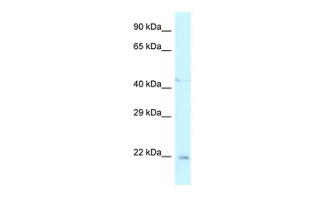 Twist1 Rabbit Polyclonal Antibody