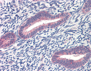 TWIST1 Rabbit Polyclonal Antibody
