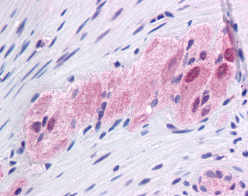 FOXC1 Rabbit Polyclonal Antibody