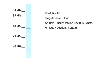 LHX2 Rabbit Polyclonal Antibody
