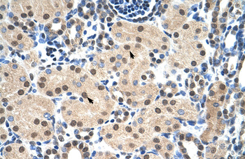 MYB Rabbit Polyclonal Antibody