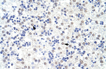 SART3 Rabbit Polyclonal Antibody