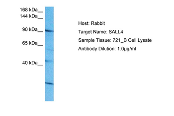 SALL4 Rabbit Polyclonal Antibody
