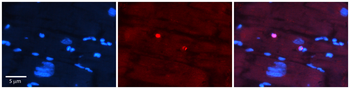 IKZF4 Rabbit Polyclonal Antibody