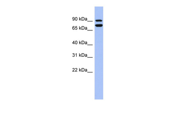 SOX6 Rabbit Polyclonal Antibody