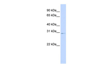 HOXA9 Rabbit Polyclonal Antibody