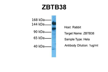 ZBTB38 Rabbit Polyclonal Antibody