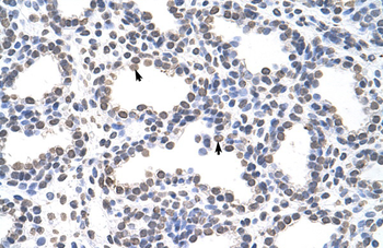 CARS Rabbit Polyclonal Antibody
