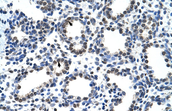 CARS Rabbit Polyclonal Antibody