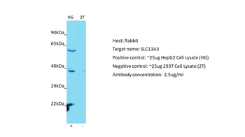 SLC13A3 Rabbit Polyclonal Antibody