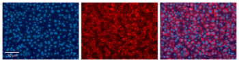 UGT1A6 Rabbit Polyclonal Antibody