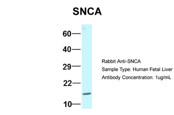 SNCA Rabbit Polyclonal Antibody