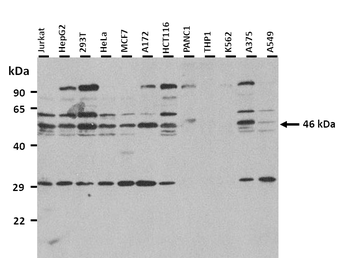 GNAS Rabbit Polyclonal Antibody
