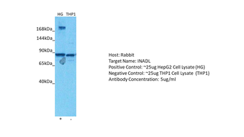 PATJ Rabbit Polyclonal Antibody