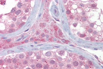 UBE2L3 Rabbit Polyclonal Antibody