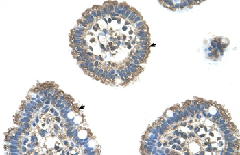 UBE2L3 Rabbit Polyclonal Antibody