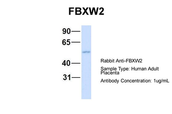 FBXW2 Rabbit Polyclonal Antibody