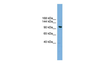 VPS41 Rabbit Polyclonal Antibody