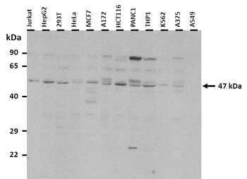 AADAT Rabbit Polyclonal Antibody