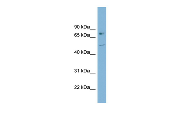 AADAT Rabbit Polyclonal Antibody