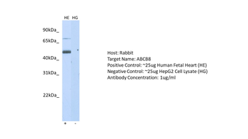 ABCB8 Rabbit Polyclonal Antibody