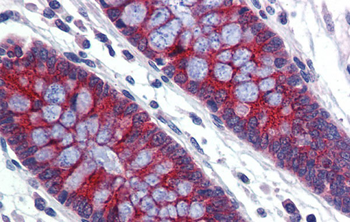 ABCA5 Rabbit Polyclonal Antibody