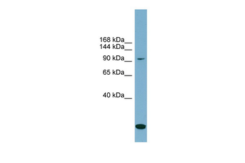 SLC12A4 Rabbit Polyclonal Antibody