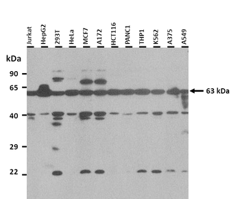 SLC5A7 Rabbit Polyclonal Antibody