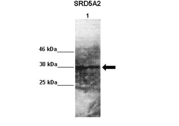 SRD5A2 Rabbit Polyclonal Antibody