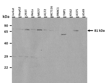 GYS2 Rabbit Polyclonal Antibody