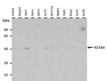 SAMSN1 Rabbit Polyclonal Antibody
