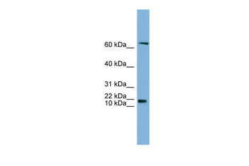 GM2A Rabbit Polyclonal Antibody