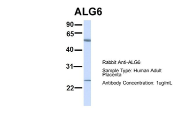 ALG6 Rabbit Polyclonal Antibody