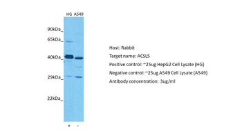 ACSL5 Rabbit Polyclonal Antibody