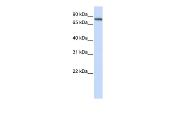 ACP6 Rabbit Polyclonal Antibody