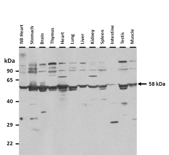 Oxsr1 Rabbit Polyclonal Antibody