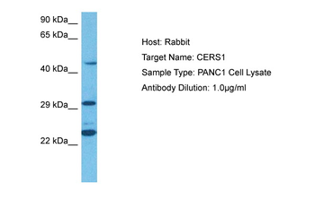 LASS1 Rabbit Polyclonal Antibody