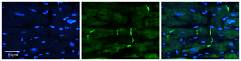 PERP Rabbit Polyclonal Antibody