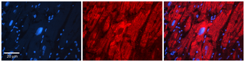 HYAL1 Rabbit Polyclonal Antibody