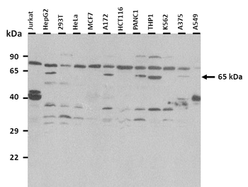 SLC47A2 Rabbit Polyclonal Antibody